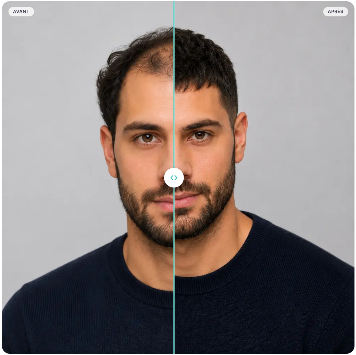 Cheveux naturels : ce qui fait le rendu d’un complément pour homme